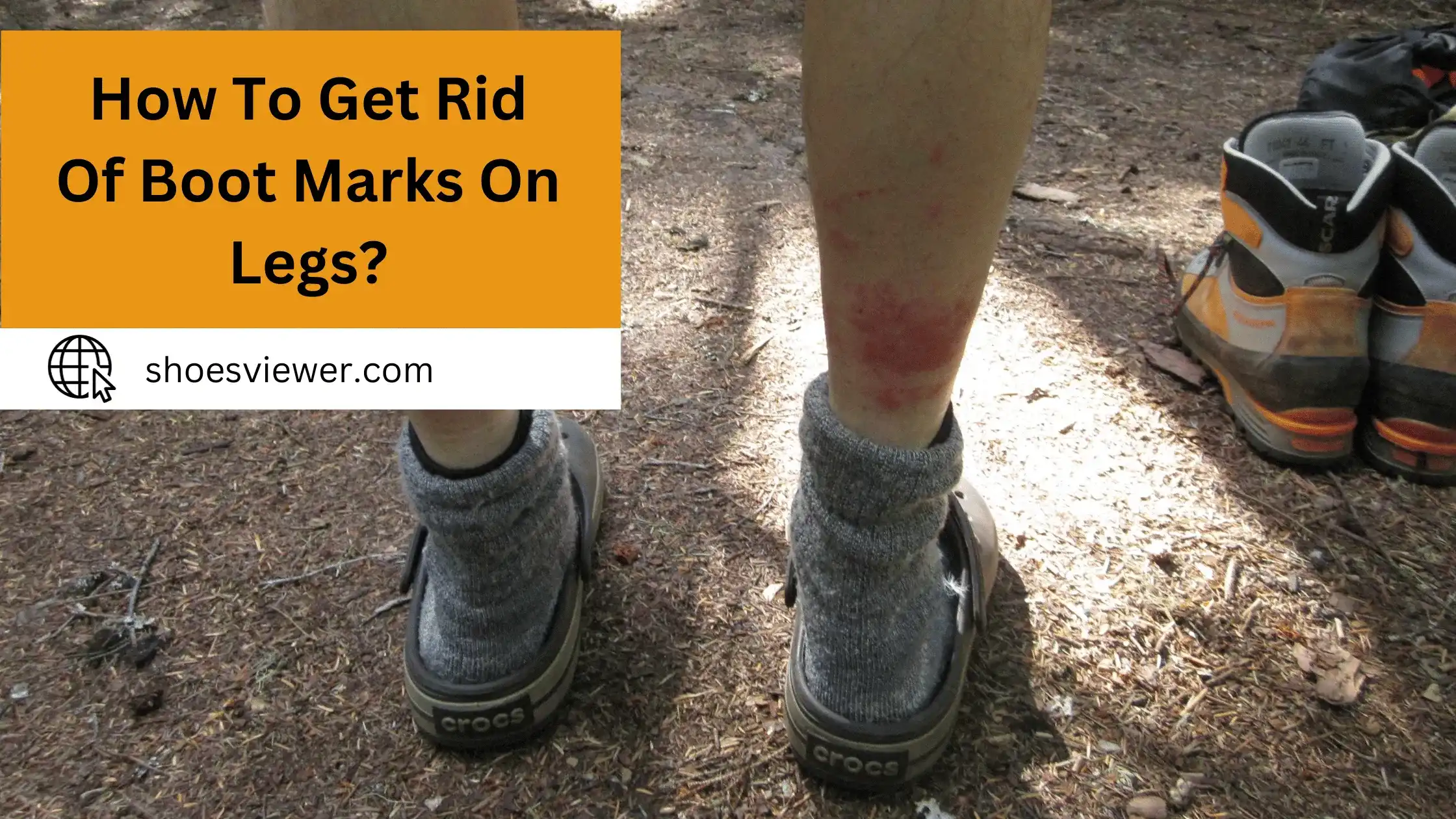 How To Get Rid Of Boot Marks On Legs? Detailed Information