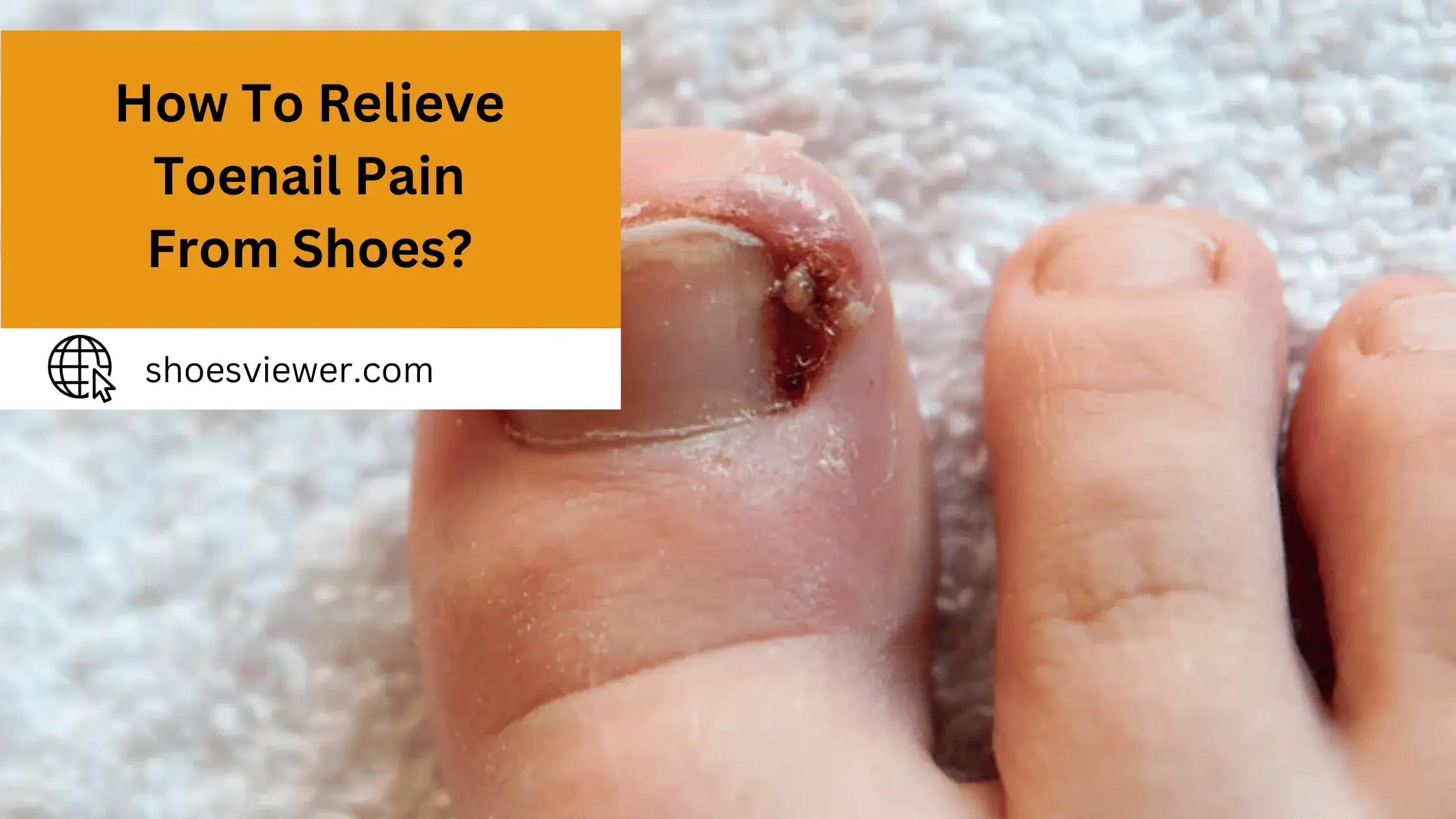 How To Relieve Toenail Pain From Shoes? Pro Tips